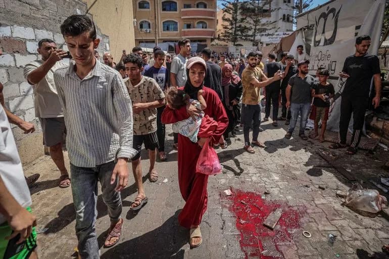Israeli Airstrike on Motorcycle Kills One in Sheikh Radwan; Child Critically Injured as Gaza’s Health System Strains