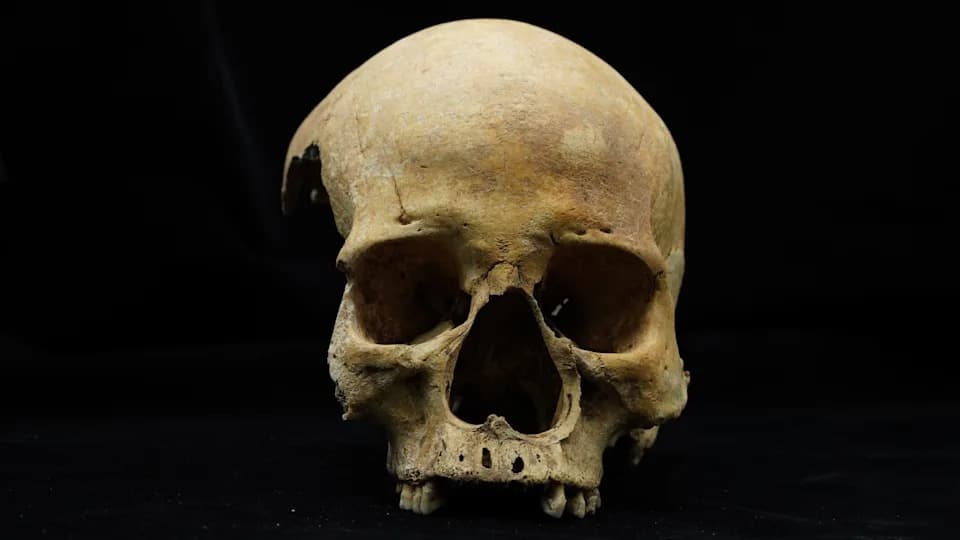 700-Year-Old Chinese Skull Provides First Skeletal Evidence Of Punitive Nose Amputation