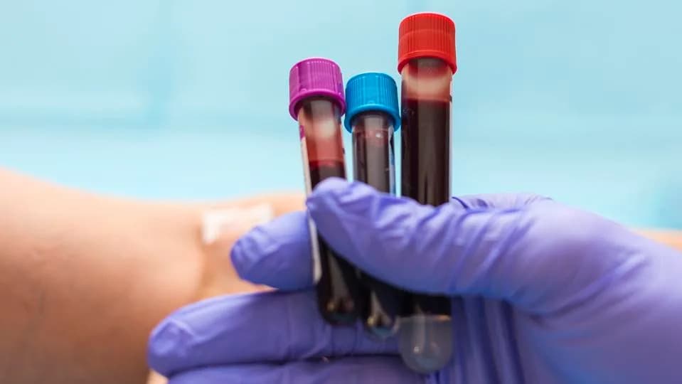 FDA Advisory Panel Weighs Galleri Multi‑Cancer Blood Test Today — What You Should Know