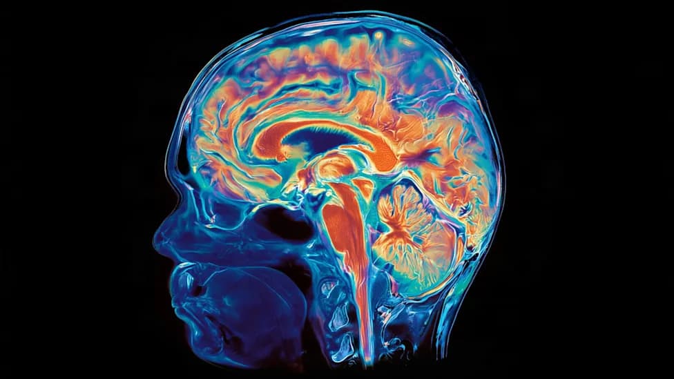 Stanford Study: Forebrain and Hindbrain Arise From Two Distinct Embryonic Lineages