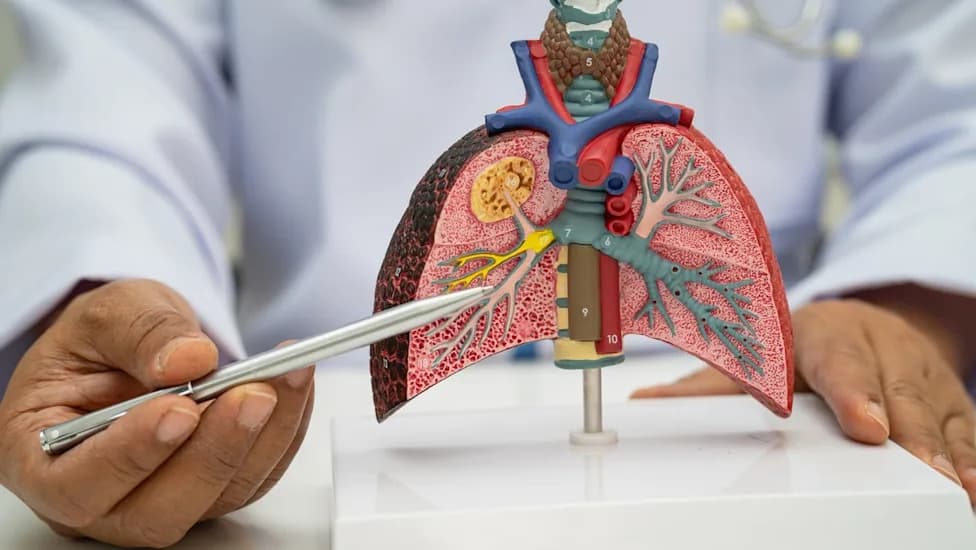 FDA Clears Cepheid's Xpert Respiratory Panel: Rapid Multiplex PCR for 13 Pathogens