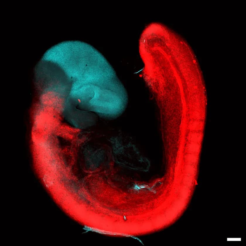 Study: Human Brain Develops From Two Distinct Embryonic Origins — A Breakthrough for ALS Research