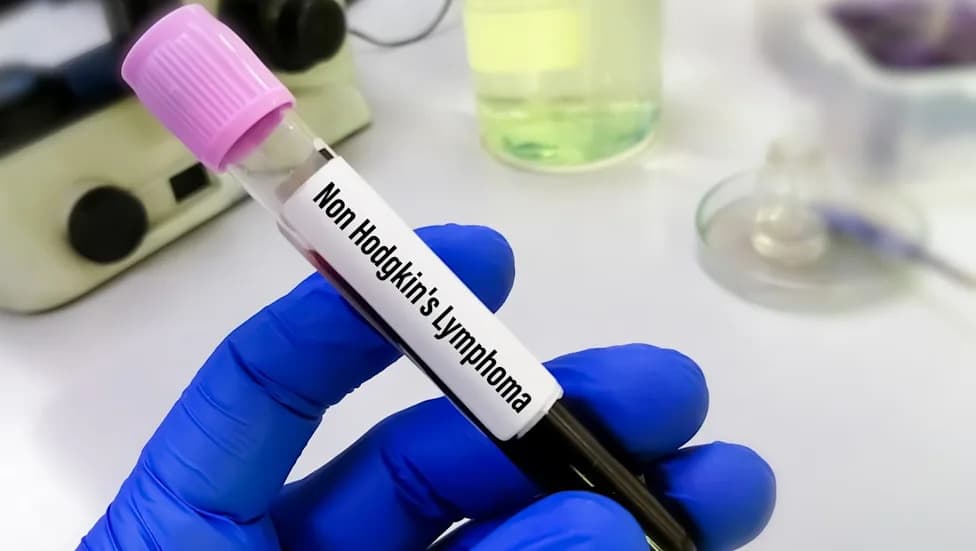 FDA Expands Approval of Lilly’s Jaypirca as First‑Line Treatment for CLL/SLL Without 17p Deletion