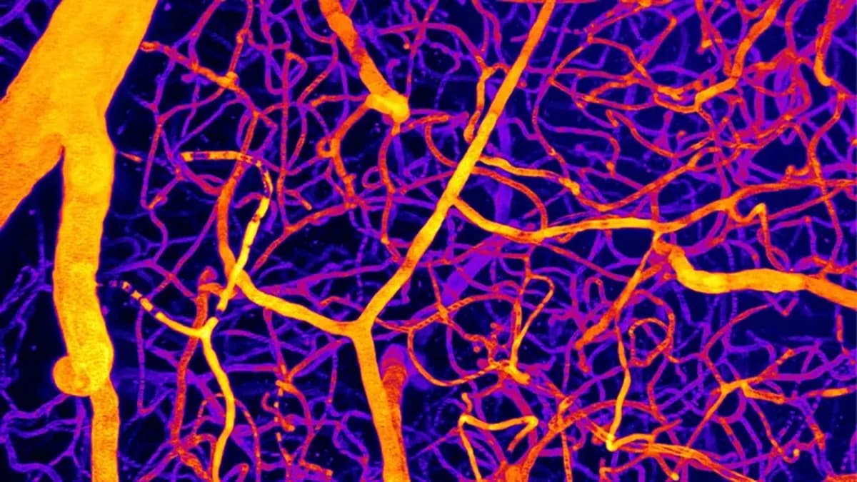 Single Lipid Molecule May Explain How Brain Blood Flow Changes Trigger Dementia