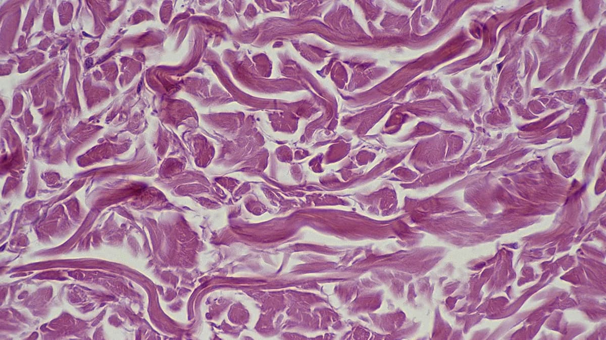 Blueprint to Revive Old Cells: Four Transcription Factors Shift Cells Toward Youth