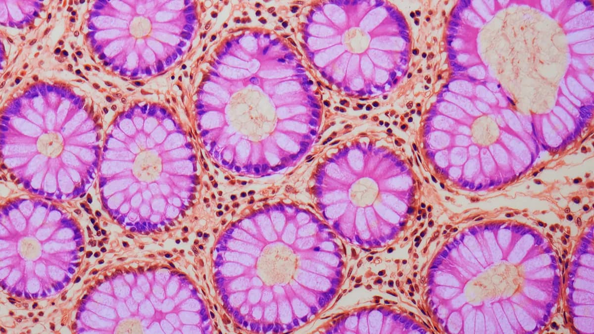 Hidden Epigenetic Warning in Gut Stem Cells Could Explain Rising Colorectal Cancer Risk With Age