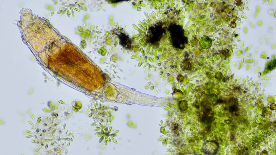 Meet the Bdelloid Rotifers: Microscopic Animals That Survive ~1,000× the Radiation That Kills Humans