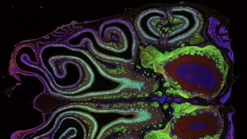 Harvard's First 'Smell Map' in Mice Reveals Hidden Order — A Step Toward Restoring Lost Smell