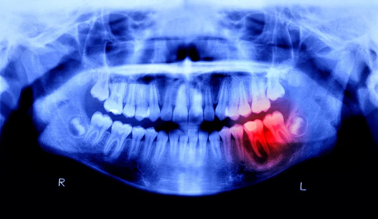 Japanese Human Trials Suggest Teeth Could Regrow — Drug Aims for 2030 Availability