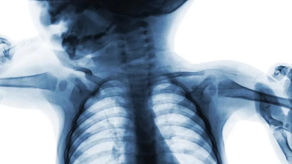 Why Babies Are Born With More Bones Than Adults — And Why That’s Clever Evolution