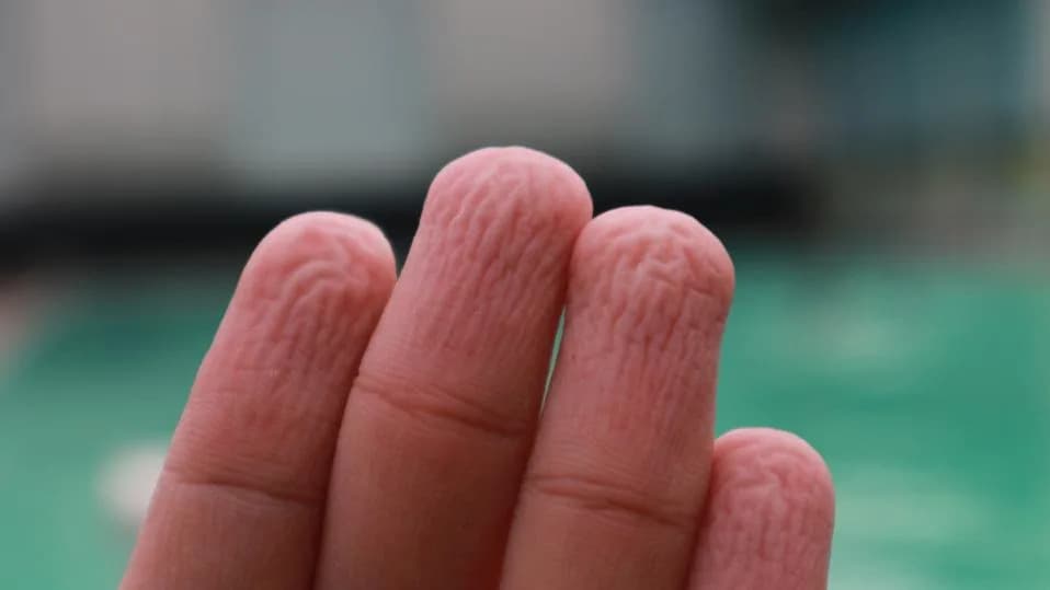 Why Our Fingers Prune in Water: The Nervous Reflex That Improves Grip (And Why It Matters)