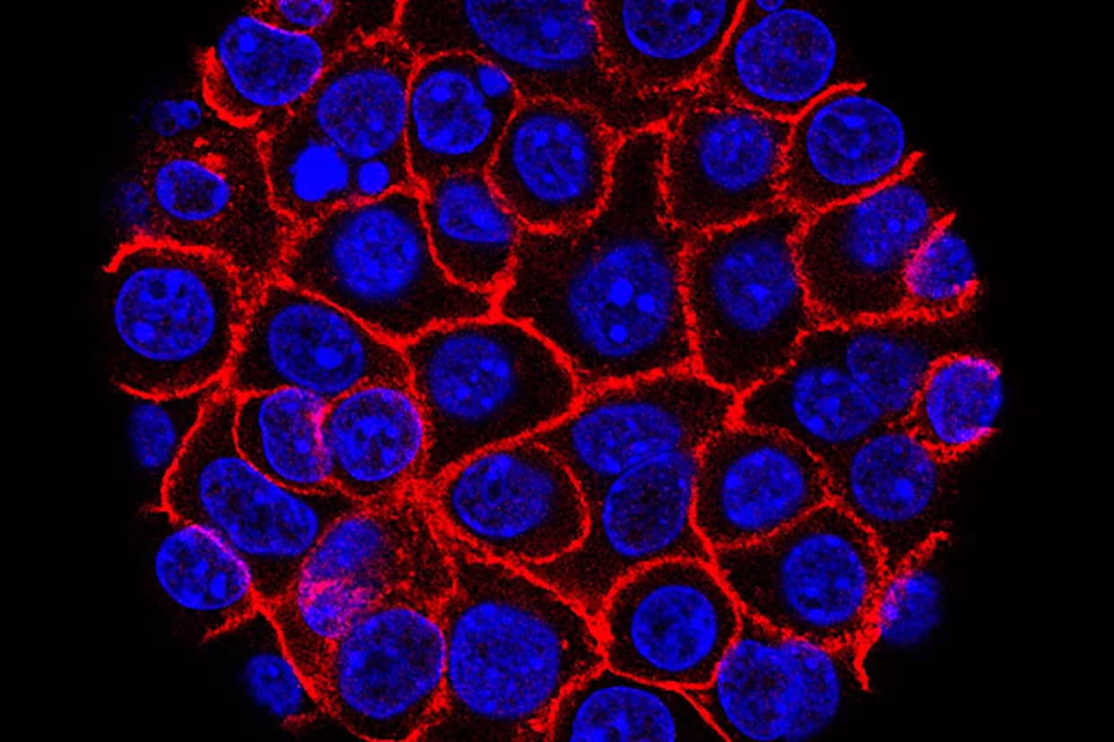 Experimental Pill Daraxonrasib Nearly Doubles Survival in Advanced Pancreatic Cancer