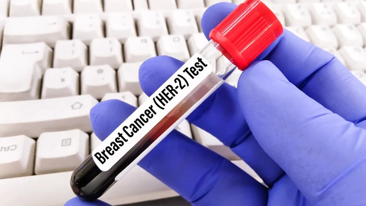 FDA Grants Priority Review to Roche’s Giredestrant as Adjuvant Therapy for Early-Stage ER-Positive Breast Cancer