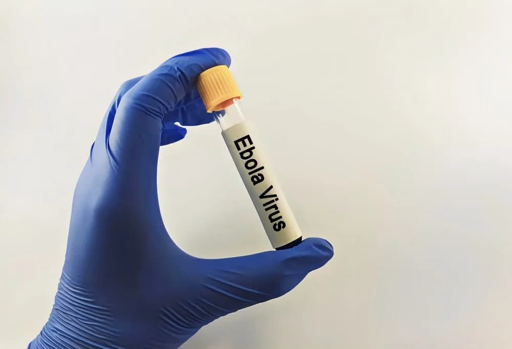 EMA and African Medicines Agency Join Forces to Fast-Track Clinical Trials for Bundibugyo Ebola After WHO Declares PHEIC