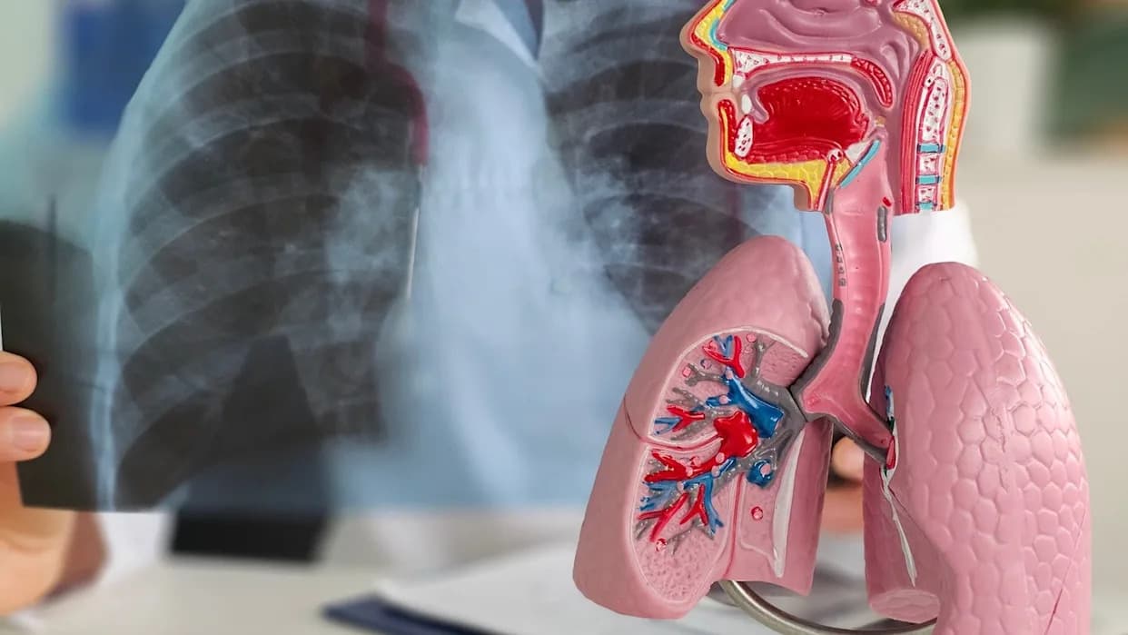 Massive Bio and Optellum Link AI-Based Early NSCLC Detection to Faster Trial Access