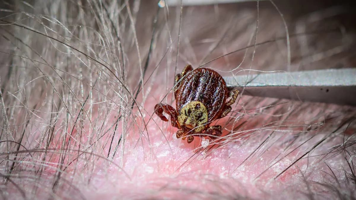 California Confirms Fourth Human Case of Emerging Tick-Borne Bacterium Rickettsia lanei