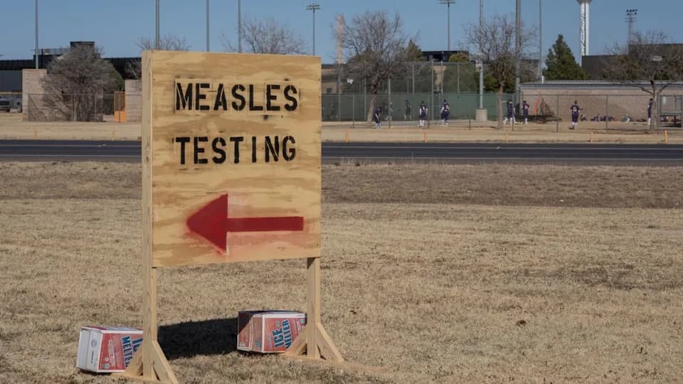 Measles Treatments Reemerge as Vaccination Rates Drop — Promising Antivirals and Antibodies Advance