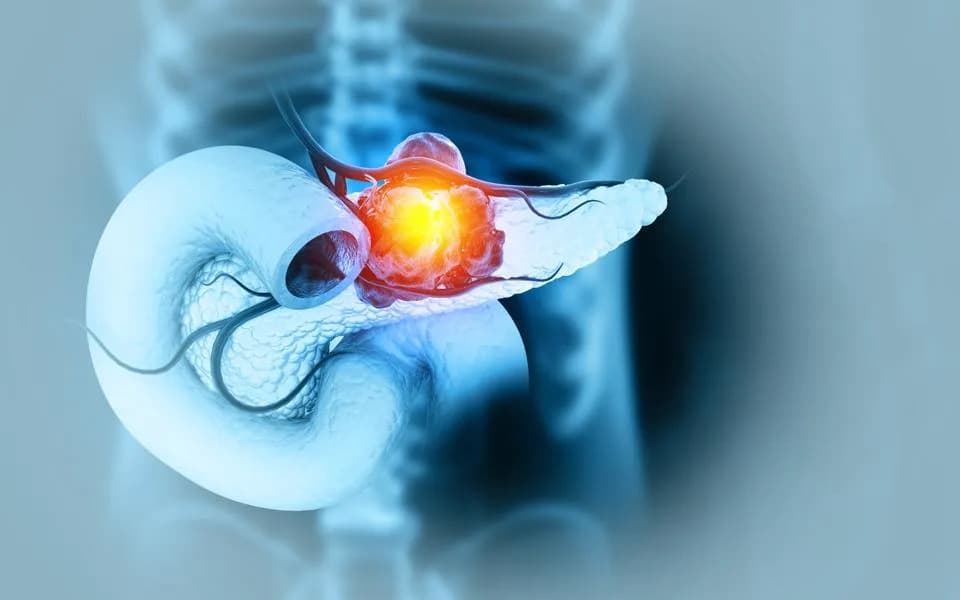 Antibodies Sneak Inside Cells to Remove Mutant KRAS, Shrinking Pancreatic Tumors in Mice