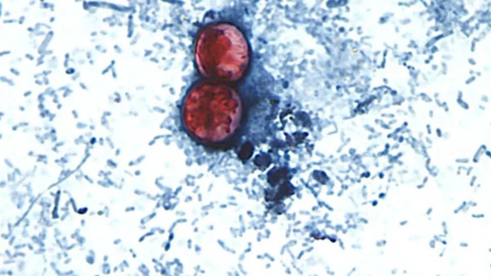 Cyclospora Outbreaks Linked to Fresh Produce: What to Know Before Eating Raw Berries and Herbs