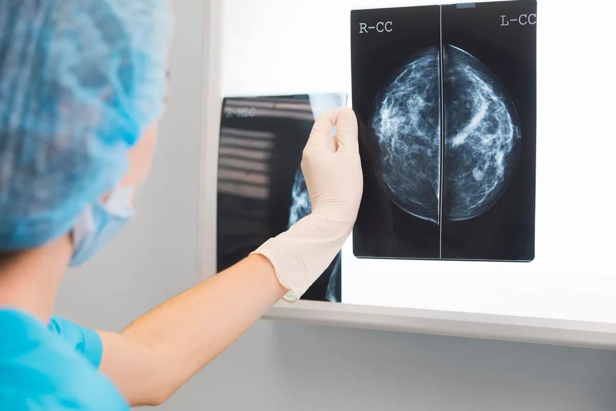Florida Patient Awarded $7M After Missed Mammogram Led To Stage 4 Breast Cancer