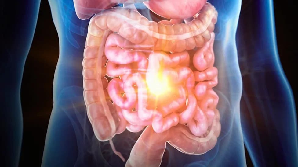 Patient-Derived 'Colon Chip' Recreates IBD — Fibroblasts Identified As Key Drivers Of Inflammation And Early Cancer Risk