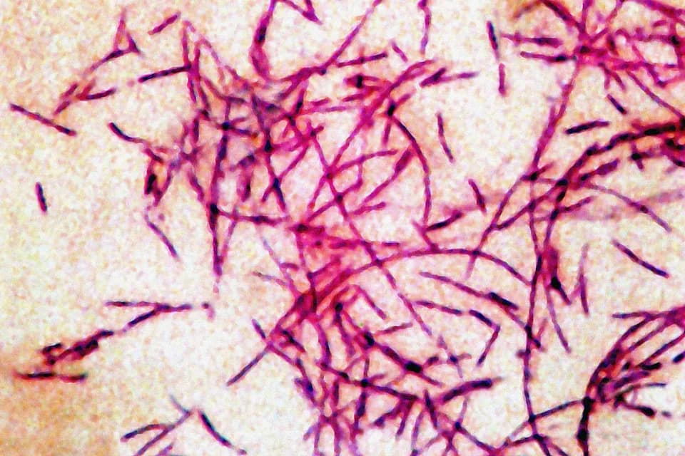 Fifth Death Confirmed in Upper East Side Legionnaires' Cluster; 82 Cases Reported
