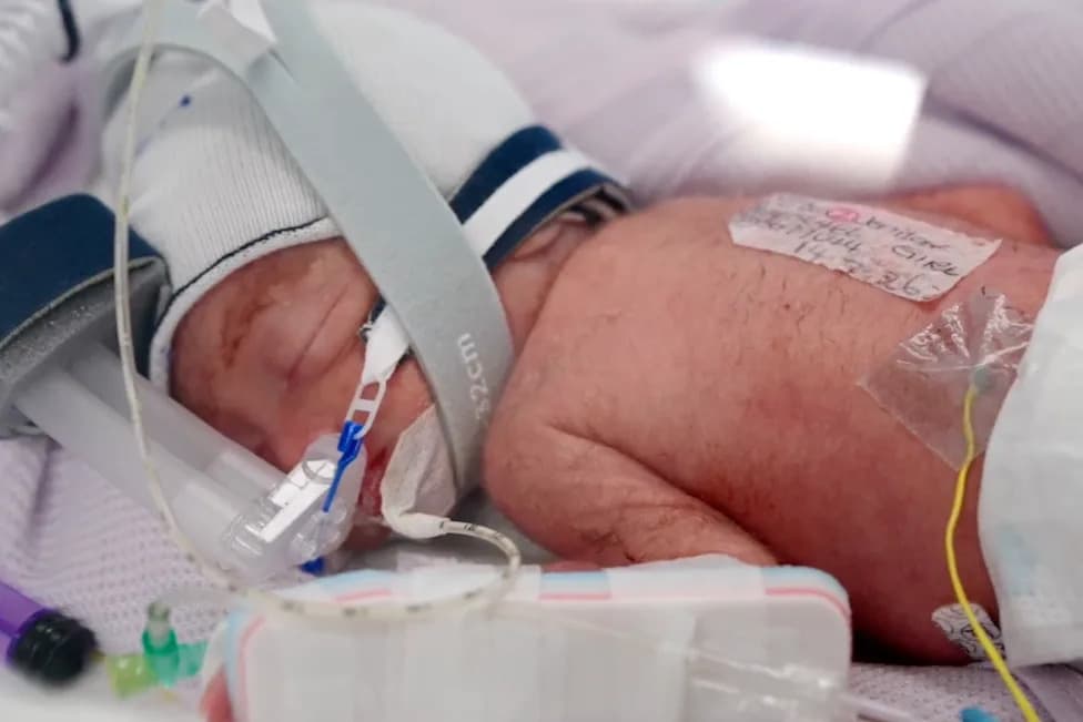 Australian Mother Delivers Naturally Conceived Identical Quadruplet Girls — A One-in-Millions Birth