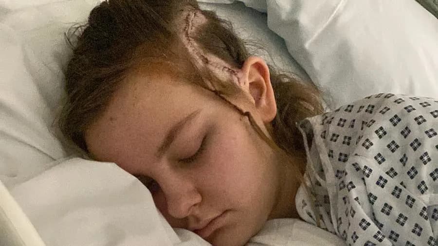 Teen Believed To Be World’s Youngest Patient To Have Awake Brain Surgery After Life-Changing Procedure
