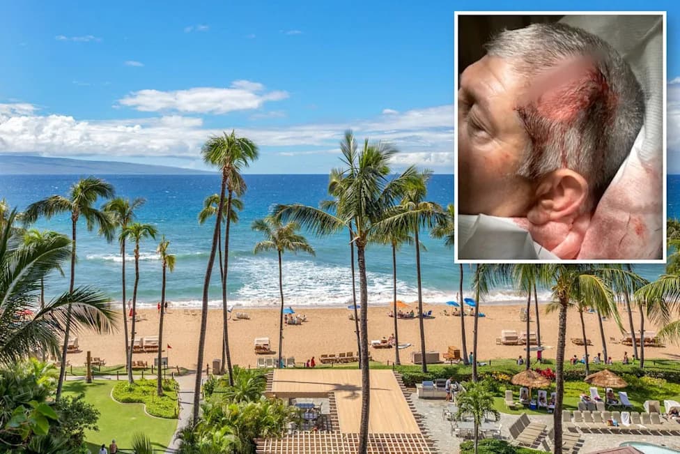 California Family Says They Were Targeted As 'Haole Boys' and Beaten at Luxury Maui Resort