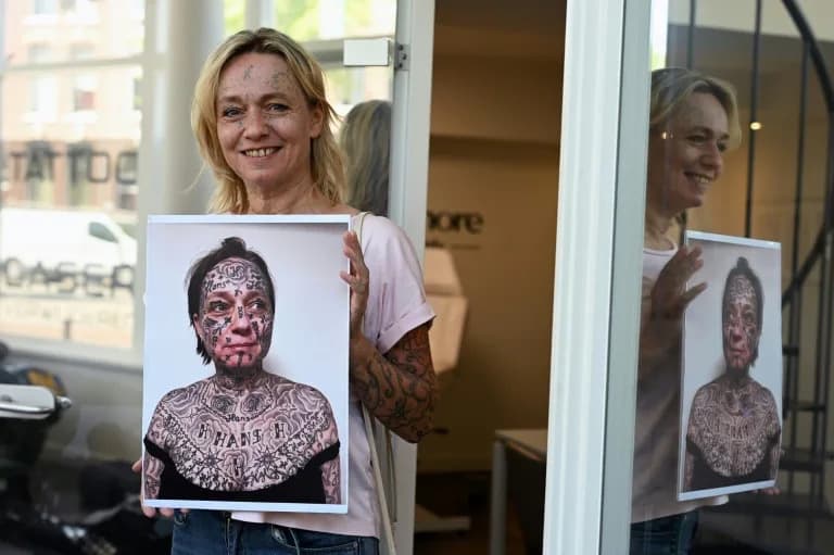 More Than Skin-Deep: Dutch Survivors Laser Away Forced Tattoos to Reclaim Their Lives