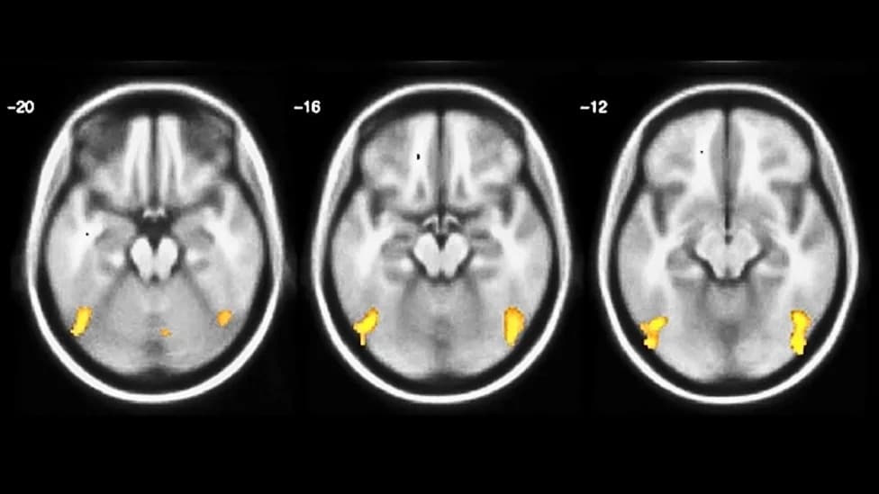Practice Rewires the Brain: How Intensive Training Enables Near‑True Multitasking