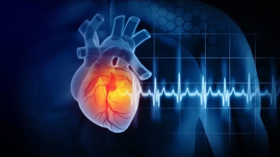 High Levels of Microplastics Found in Blood of Severe Heart Attack Patients