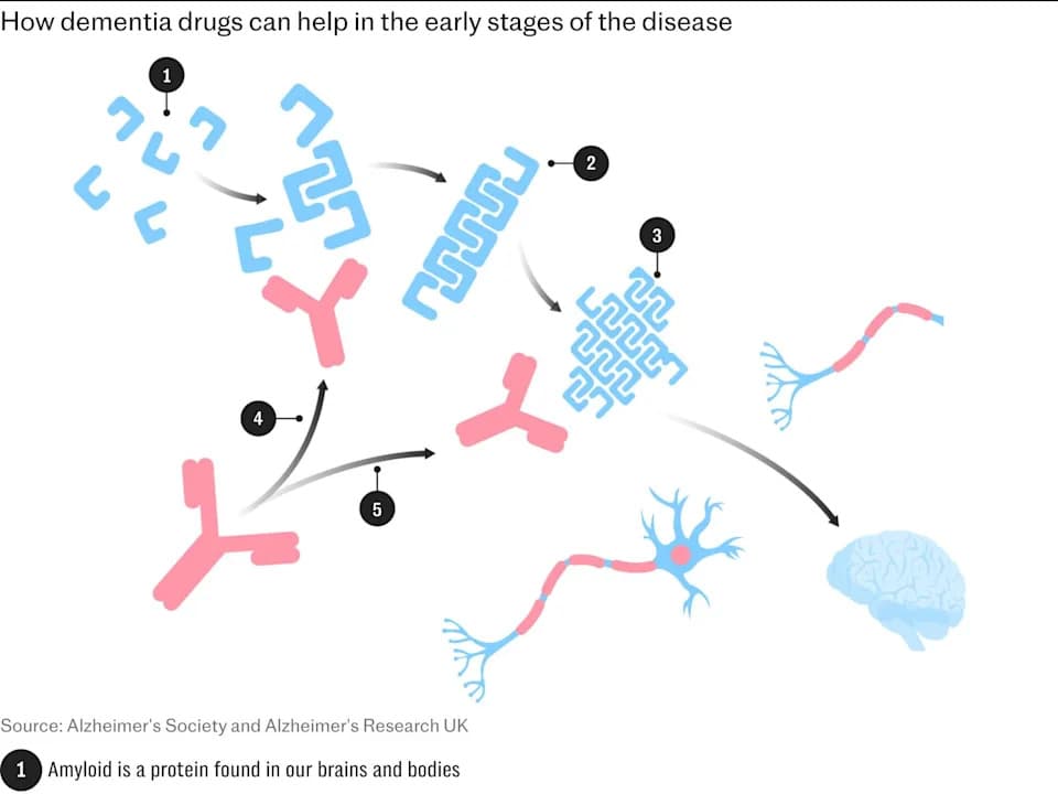 NHS Opens Commercial Talks To Secure First Disease‑Slowing Alzheimer’s Drugs