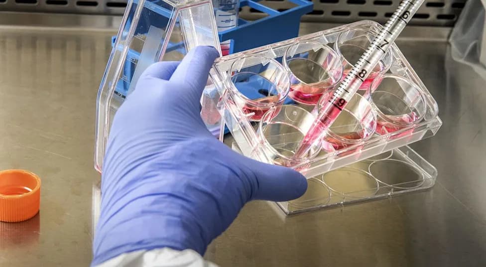 EU Approves AbbVie’s Rinvoq for Severe Alopecia Areata in Patients 12+ — Phase 3 Trials Show Marked Hair Regrowth