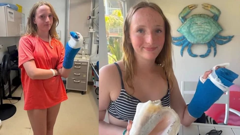 Texas Teen Bitten by Barracuda During Birthday Vacation — Jewelry Suspected to Have Attracted Fish