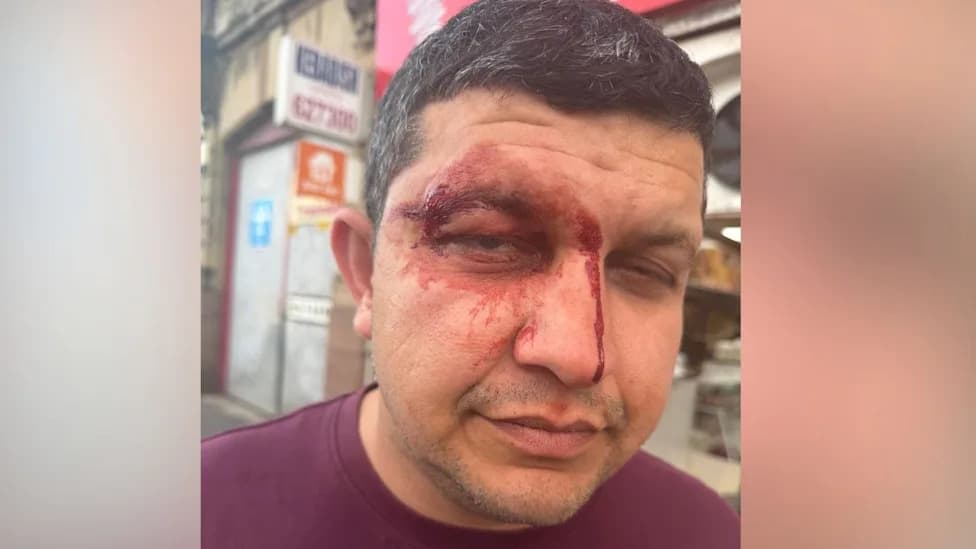 Falkirk Takeaway Owner Says He Was Racially Abused Then Violently Attacked on Grahams Road