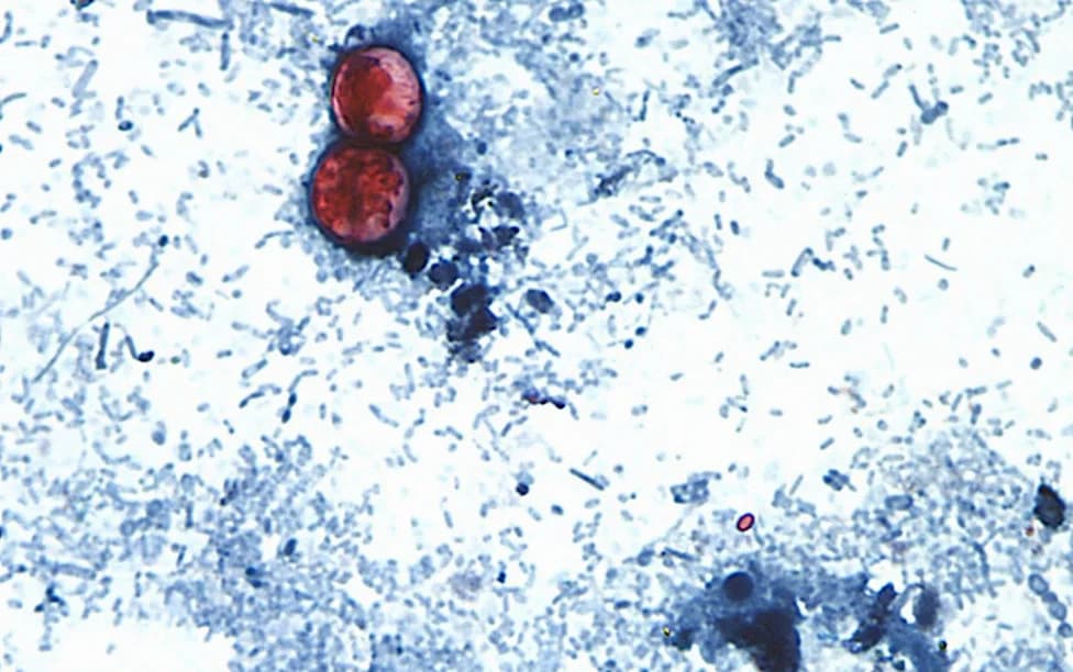 Two Dead As Cyclospora Outbreak Linked To Mexican Lettuce Spreads To 41 US States