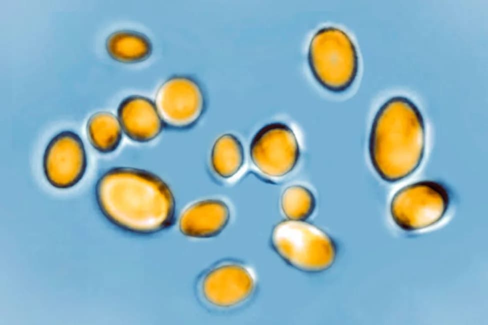 Drug-Resistant Candida auris Spreads to 23 States — 3,130 U.S. Cases As Of Mid‑July 2026