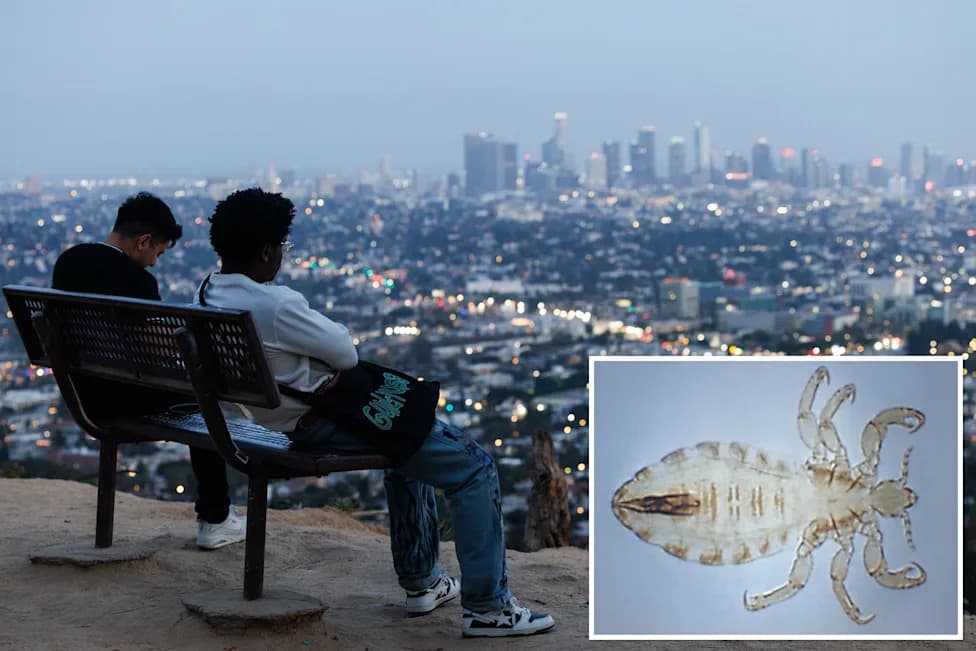 After Typhus Returns To Los Angeles, Could Bubonic Plague Follow?