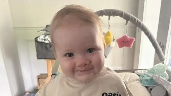 Father Fears Time-Critical Cleft Surgery Delay After Northern Ireland's Only Specialist Resigns