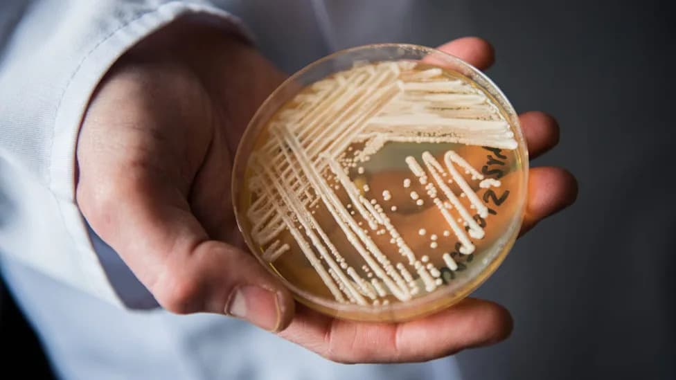 Candida auris Is Rising Again in the U.S.: What You Need to Know