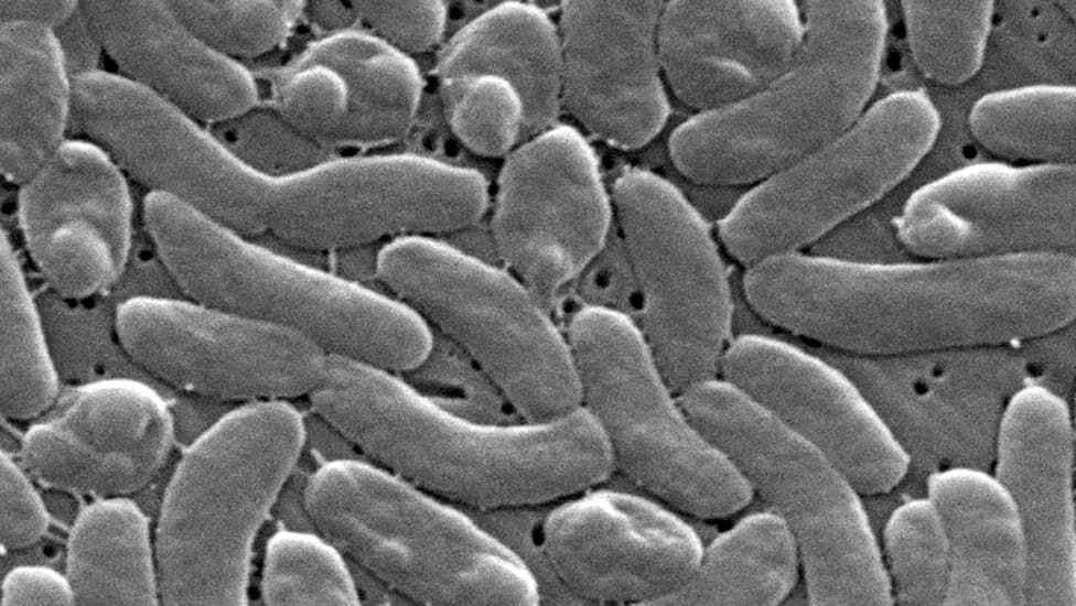 Deadly 'Flesh‑Eating' Vibrio Surge: Gulf Coast Officials Urge Caution for Beachgoers