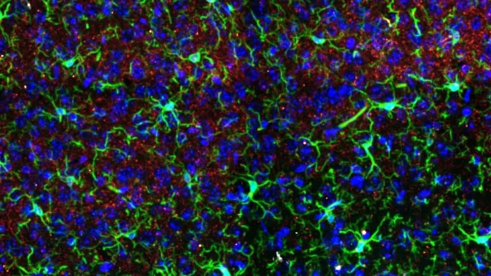 Ketamine Spurs Female‑Specific Brain Remodeling in Mice, Study Finds