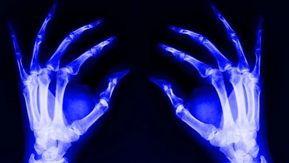 A Hidden Driver Of Aging May Start In Your Bones — Study Links Bone Marrow Stem Cells To Systemic Inflammation