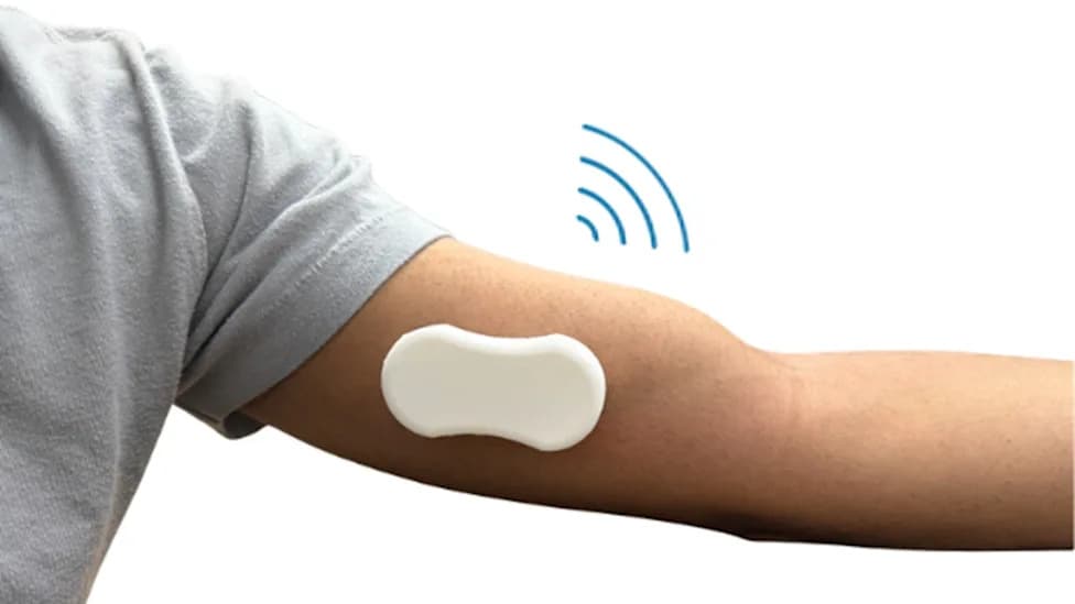 Beacon Wearable: University of Illinois Device Detects Dialysis Access Failure Early
