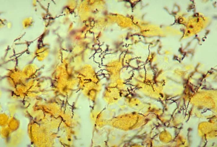 Gut Microbes Linked to Psychopathic Traits? Small Study Finds Correlations, Not Causation