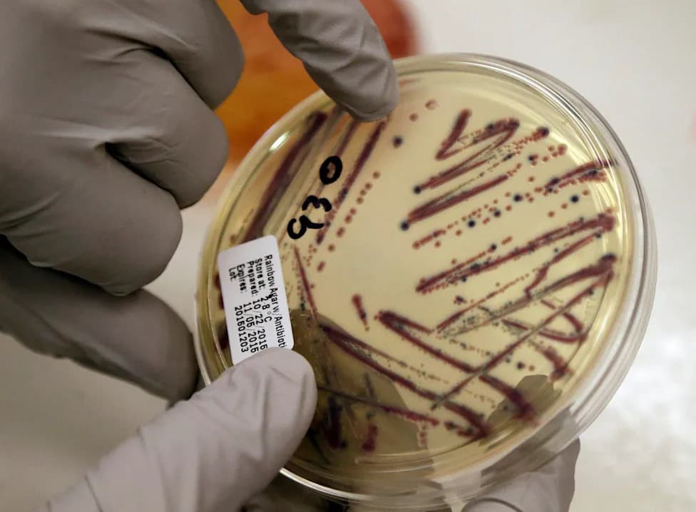 Health Alert: Alfalfa Sprouts Linked To Multiple E. Coli And Salmonella Cases In MN, WI