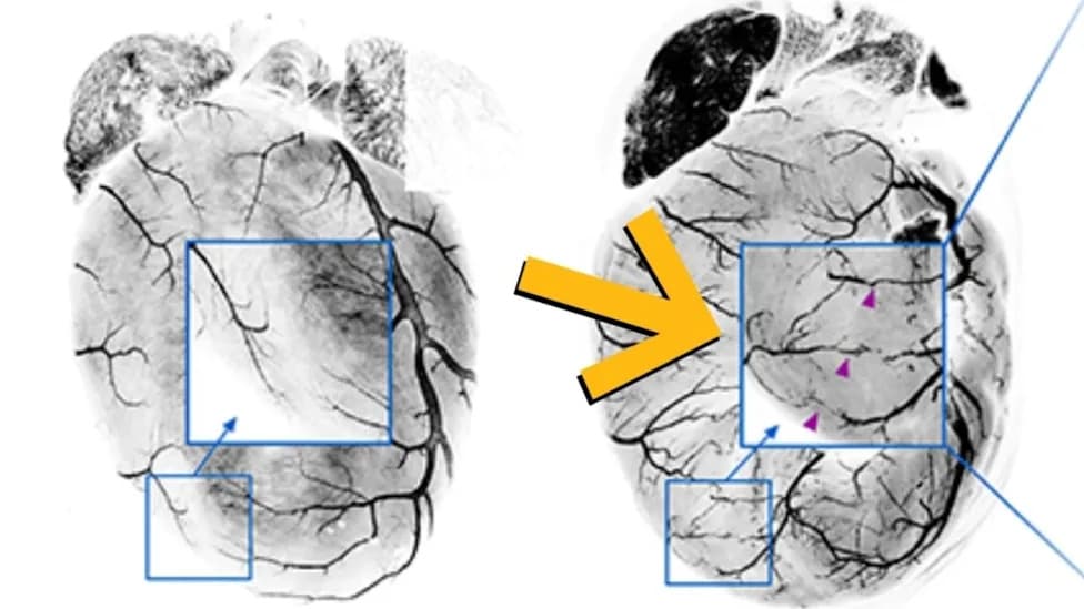 Tiny Capillaries Build Natural Bypasses After Heart Attacks — Mouse Study Points To New Therapy Target