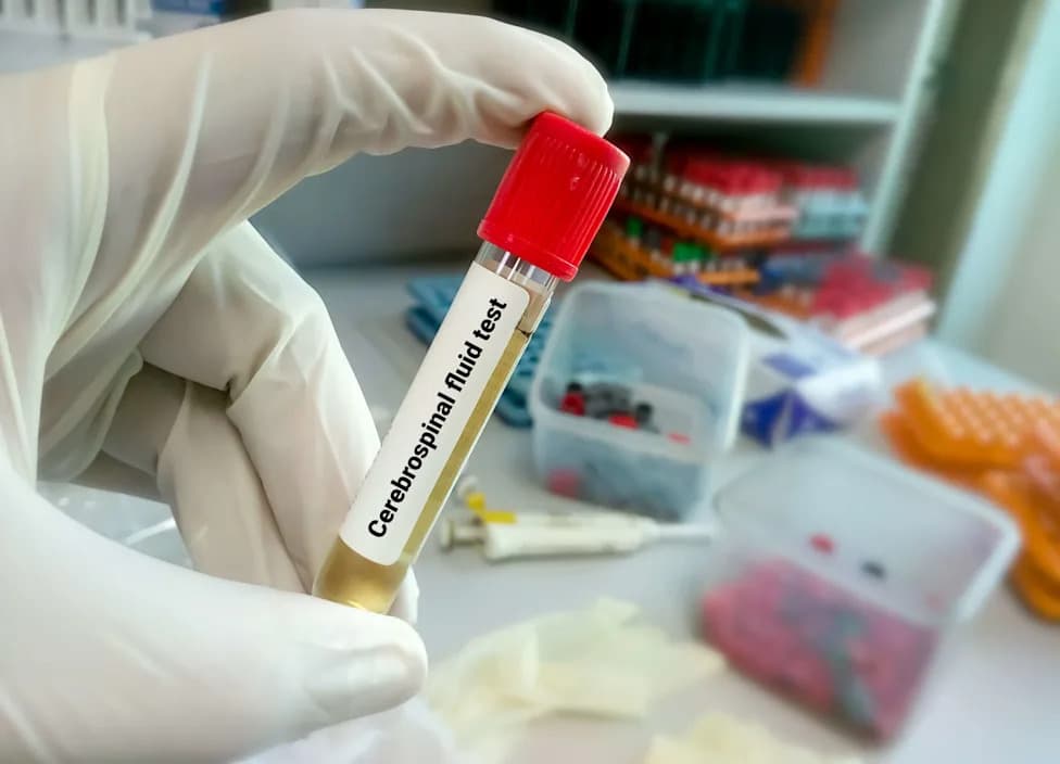 Tiny Plastics Found at Higher Levels in Spinal Fluid of People With ALS — Italian Study Raises New Questions