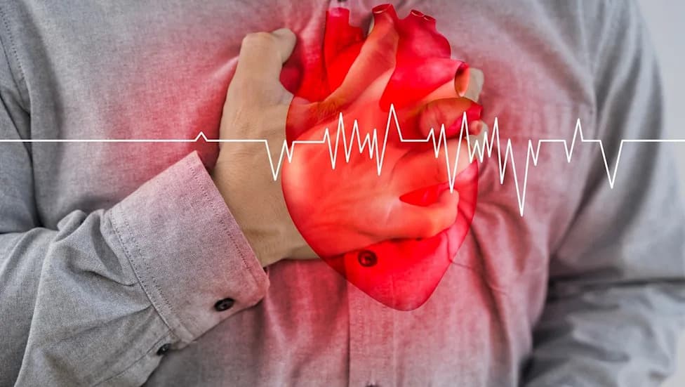 Milestone Launches Pivotal Phase III Trial of Etripamil Nasal Spray for AFib With Rapid Ventricular Rate